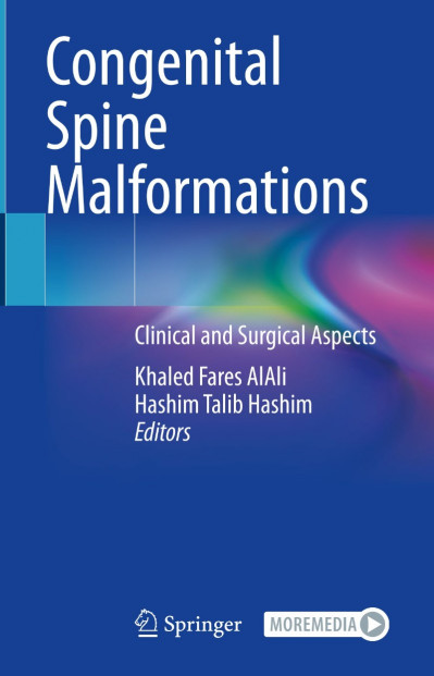 Congenital Spine Malformations: Clinical and Surgical Aspects - Khaled Fares AlAli... A6e51680fa446d66e8d026d737132f2b