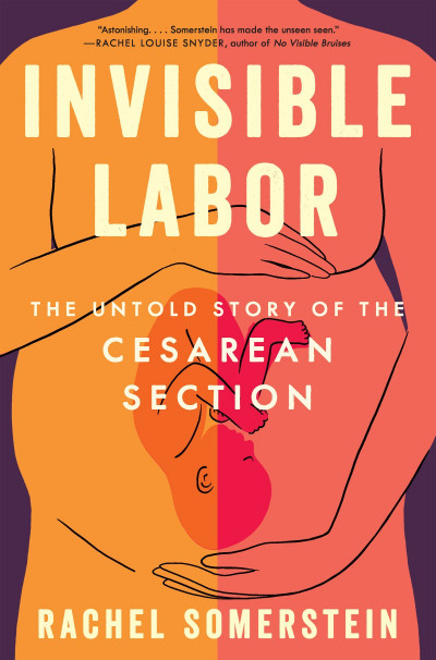 Invisible Labor: The Untold Story of the Cesarean Section - Rachel Somerstein 27e2dec7679dc24e100233965031beab