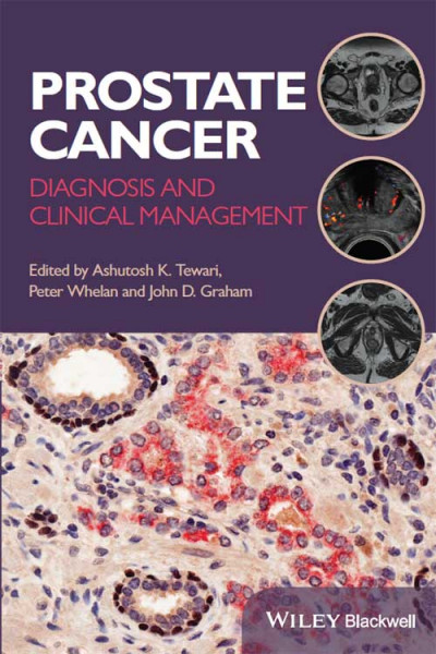 Diagnosis and Management of Hereditary Cancer: Tabular-Based Clinical and Genetic ... Bf32badb010c217ec990722487f271bd