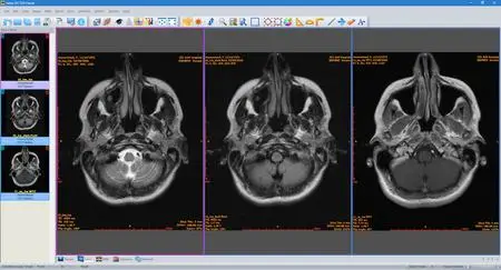 Sante DICOM Viewer Pro 14.0.11