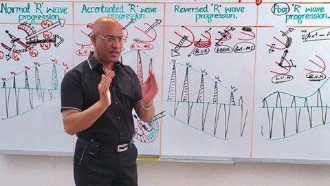 Master Fundamentals Of Ecg  Ekg