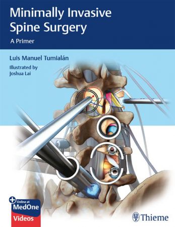 Minimally Invasive Spine Surgery: A Primer 1st Edition (True PDF Plus Videos)